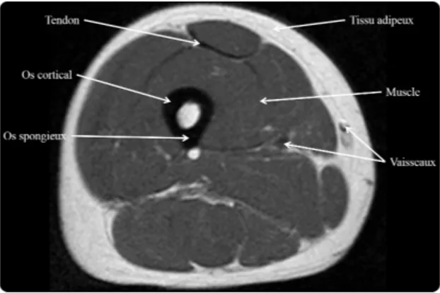 Figure I.9. Tissus caractéristiques de la coupe de la cuisse par imagerie IRM.