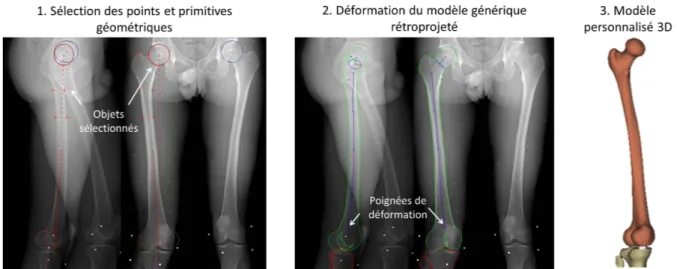 Figure II.2. Modélisation 3D du fémur (Chaibi et al., 2011; Quijano et al., 2013) : 1