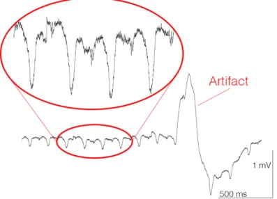Figure 0.2 – ECG d’une souris avec présence d’un artefact.