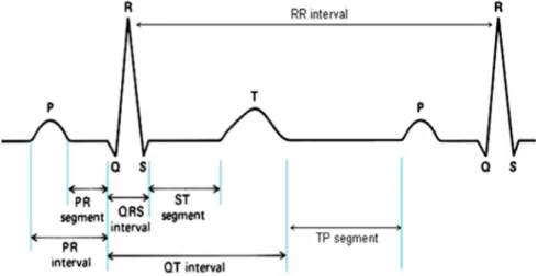 Figure 1.4 – Signal ECG avec ses caractéristiques importantes [ 26 ].