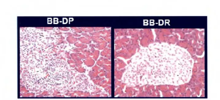 Figure 1 : Infiltration des îlots  p  par les cellules T. Une fois les cellules T infiltrées, il y a  destruction et perte de fonction des  îlots~  (à  gauche) (adapté de Colle et al.,  1981)