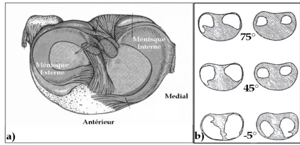Figure 7 :  a) Les ménisques, vue axiale du plateau tibial. b) Surfaces portantes fémoro-tibiales pour le genou intact  (à gauche) et après une double méniscectomie 4  (à droite) [MAQ1993]