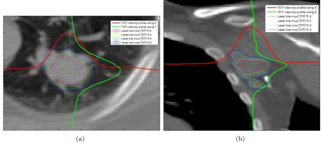 Fig. 2.2 – Profils d’intensités TEP superposés à des images TDM pour : (a) une tumeur pulmonaire et (b) un glanglion lymphatique infecté
