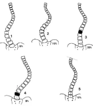 Figure 12 : Classification de King 