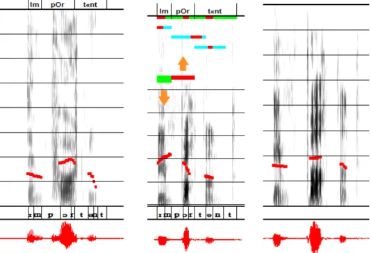 Fig. 3. Example of automatic diagnosis and speech modifications. Each panel shows the  spectrogram, the melodic curve (in red) and the waveform (at the bottom, also in red) of a  realization of the word &#34;important&#34;