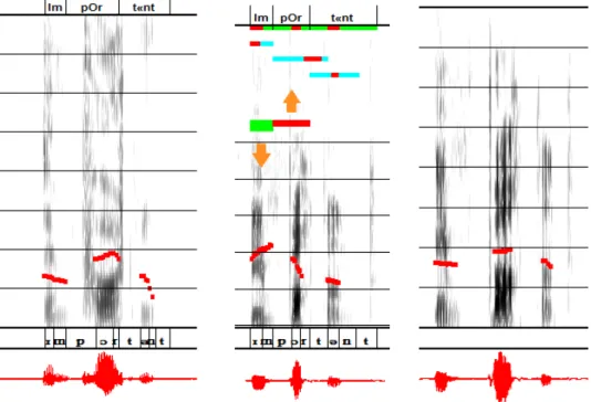 Fig. 3. Example of automatic diagnosis and speech modifications. Each panel shows the  spectrogram, the melodic curve (in red) and the waveform (at the bottom, also in red) of a  realization of the word "important"