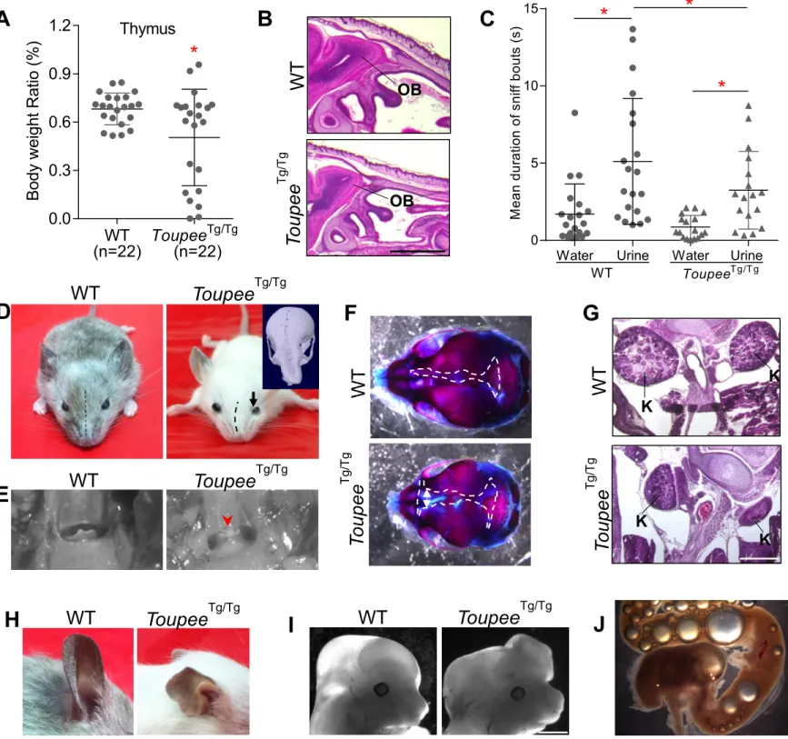 Figure S2 mice exhi revealing  showing th mice displ Frontal vie double-sta subset of  hypoplasia heads dem bubbles