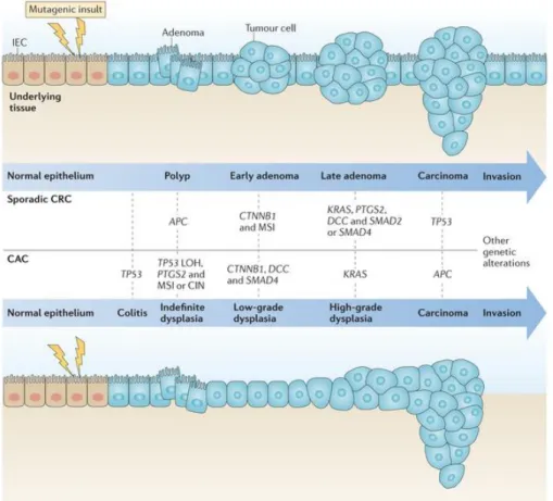 Figure 5 : Les différents stades de développement du cancer colorectal selon de le type  de cancer et la séquence chronologique des mutations associée (adapté de West et al