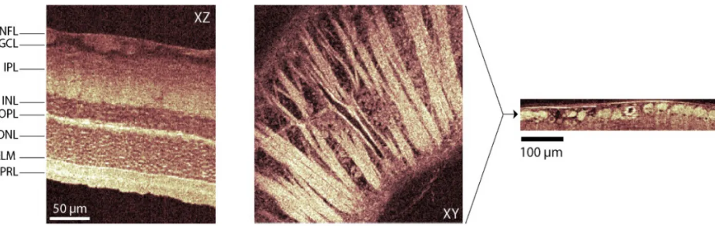Figure I.17 : Images tomographiques obtenues par OCT plein champ d’une rétine de rat ex  vivo  à droite  et coupe transverse des différentes couches du nerf optique  à droite   58 . 
