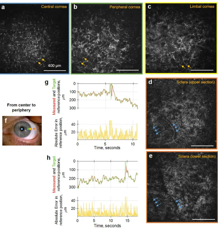 Figure 4.8 – Common-path FF/SD OCT imaging of peripheral, limbal human cornea and sclera