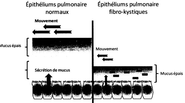 Figure 2. Comparaison de la clairance mucocilliale de patients 