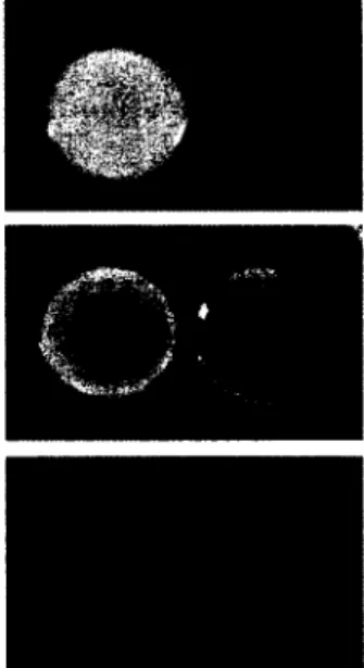 Fig. 2. Growth  complementation  of  a SCV  (right  spot)  by a co-isolated  S. aureus  strain (left  spot)