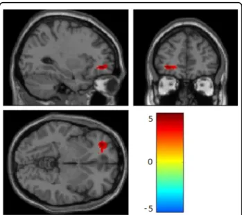 Fig. 1 Greater within-pair difference in peripheral SLC6A4 promoter methylation was associated with greater responses to sad stimuli in left orbitofrontal cortex (T = 5.11, pFWE = 0.032)