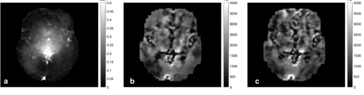 Figure 3.4 shows the application of this method to subject 1. Images a and b are the average shear stiffness values for ON and OFF sequences,  respec-tively, shown in 19 slices