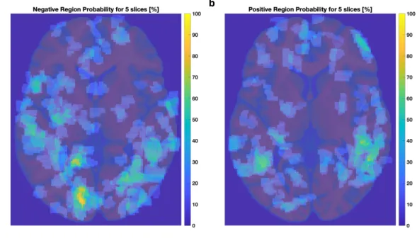 Figure 3.19 shows the cerebrovascular atlas developed by Bernier et al., [ 4 ] and the thresholded volumetric reprojection of the negative (SF &lt; 1) and positive (SF &gt; 1) activation regions in blue and green, respectively, from