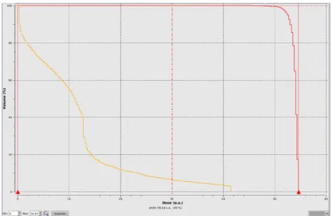 Figure 10: Exemple d'HDV. L'axe vertical représente le volume, et   l'axe horizontal la dose reçue