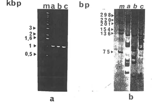 Figure l .Typage par polymorphisme de la longueur des fragments régénérés par les enzymes de  restriction Alu 1 et Msp I sur le gène codant la  PPME amplifié par PCR: 