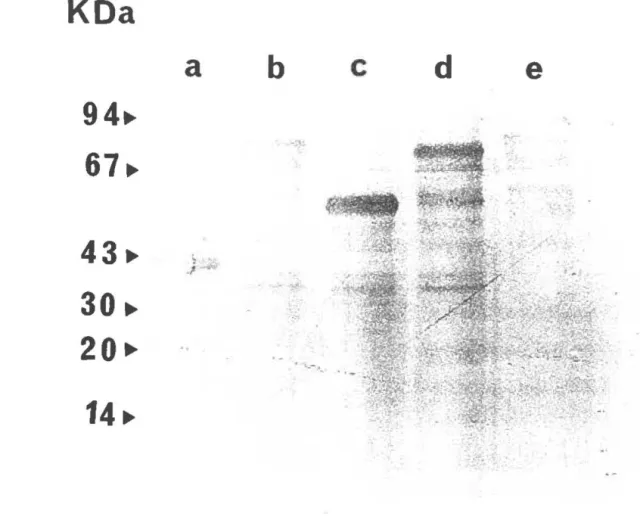 Figure 9.  Mise en évidence de l'expression de la protéine recombinante Mal E-PPME L2 après  induction: Des extraits de bactéries E