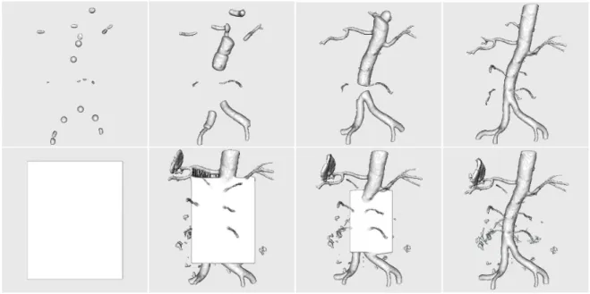 Figure 4.11: Segmentation of blood vessels from MRA, starting from two different initial- initial-izations: 20 seed points (top row) and a bounding box (bottom row).