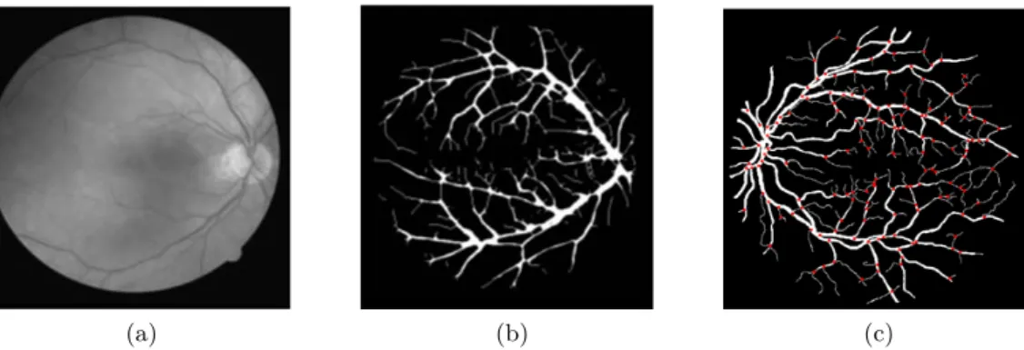 Figure 2.7: Le processus de caractérisation basé sur la détection de l’arbre vasculaire : (a) L’image rétinienne d’entrée, (b) la détection de l’arbre rétinien et (c) l’extraction des points de bifurcation de l’arbre vasculaire.