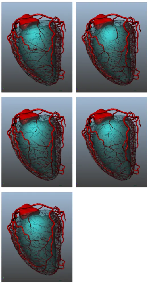 Figure 20 – Results with 5 varying random seeds on the same patient (case 6 ): 6000 terminal segment networks