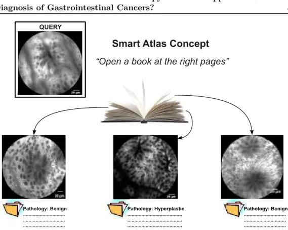 Figure 1.3: Schematic example illustrating the “Smart Atlas” concept for pCLE. The example images are typical pCLE images of colonic polyps