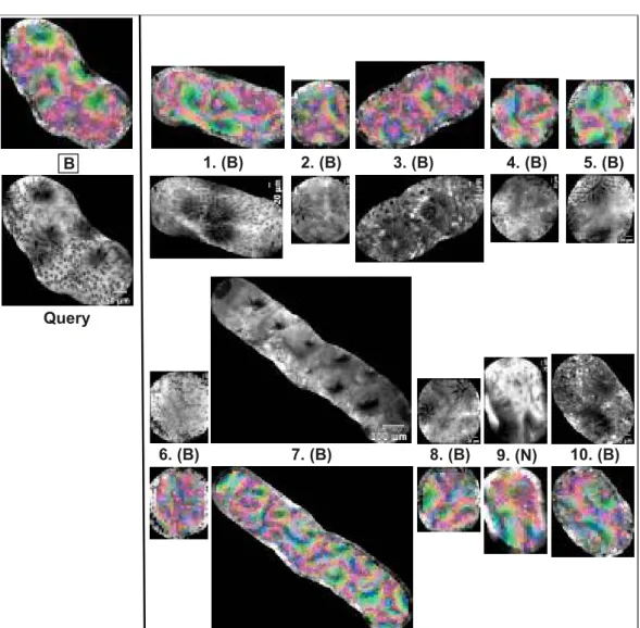 Figure 2.19: The 10 most similar pCLE video sub-sequences (right) for a benign query (left), retrieved by the LOPO Weighted-ImOfMos method