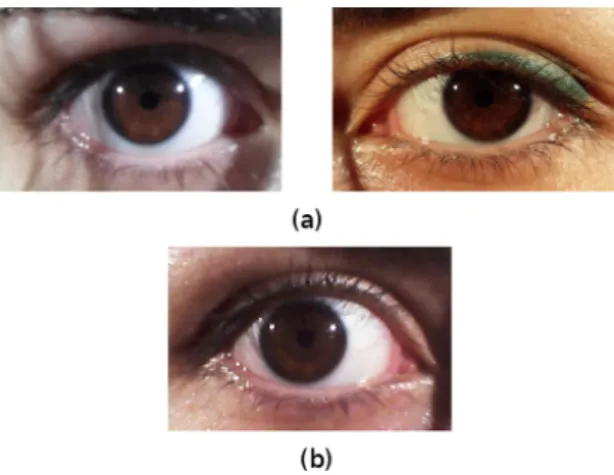 Figure 1.3: MICHE I iris images example. (a) Images acquired with Samsung Galaxy S4 rear camera (left) and front camera (right); (b) Image captured with Samsung Galaxy Tab 2 front camera.