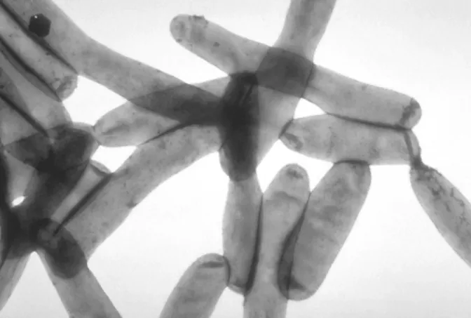 Figure 2.1 : Legionella pneumophila en microscopie électronique à transmission.  [Par CDC (PHIL #1187) — CDC Public Health Image Library., Domaine public,  https://commons.wikimedia.org/w/index.php?curid=841034] 