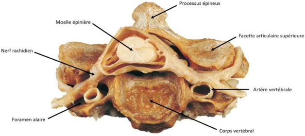Figure 8 : Dissection transverse de la moelle épinière dans une vertèbre cervicale, adapté de Tortora et Derrickson 2017 