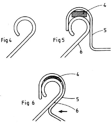 Figure 7 : schéma en trois phases du processus de dudgeonnage. 