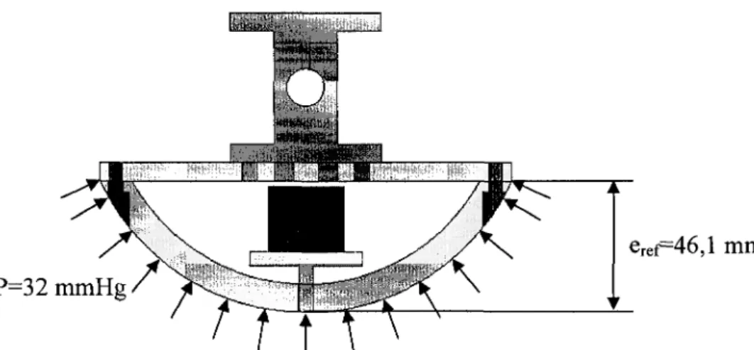 Figure 4.15 Application d'une pression uniforme de 32 mmHg sur le capteur cylindrique