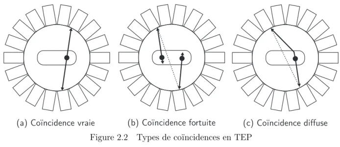 Figure 2.2 Types de coïncidences en TEP