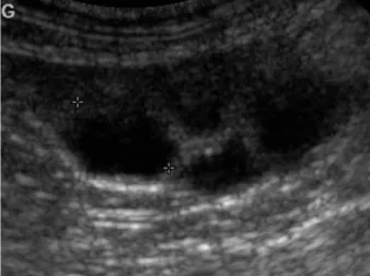 Figure 10  : Image échographique d’ovaire de chienne obtenue par voie  transabdominale