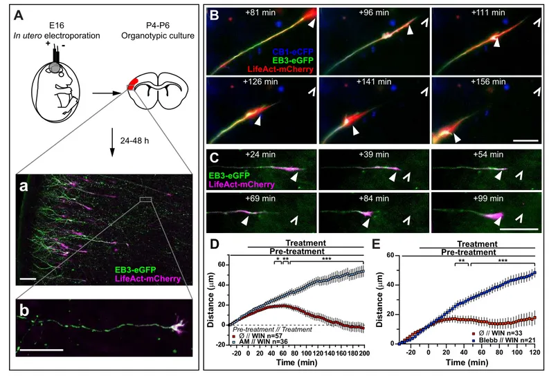 Figure 4. Activation of exogenous or endogenous CB1Rs modifies growth cone dynamics ex vivo