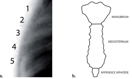 Figure 6 – a.Radio de profil du sternum d’un enfant de 1 an dont la sternèbre 2 n’est pas complètement ossifiée (Rush et coll., 2002), b.Sternum adulte