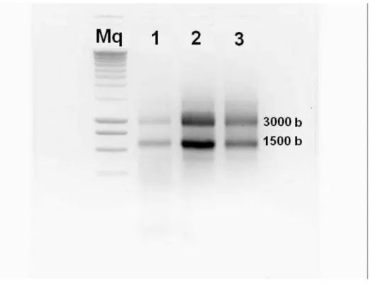 Figure 26 Electrophorèse sur gel d’agarose 1% réalisé avec de l’eau DEPC sur 3 échantillons d'ARN (1, 2  et 3)