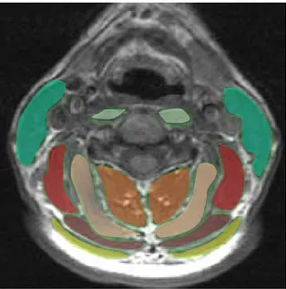 FIGURE  23.  Exemple d'image du rachis cervical obtenues en coupe axiale en C2-C3 par IRM