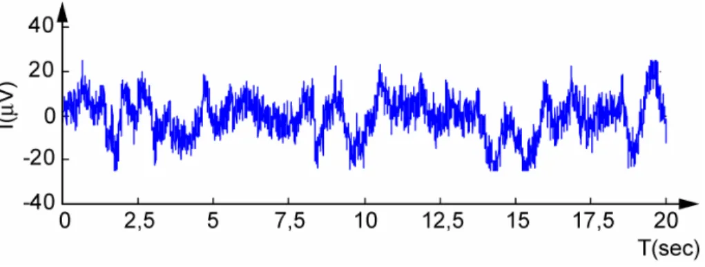 Figure 8 : exemple d’enregistrement EEG (ici chez l’homme, échantillonné à 200 Hz). 