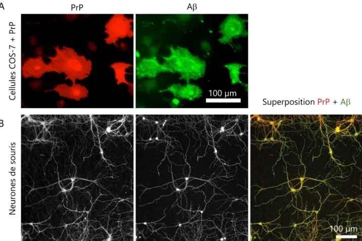 Figure 16 : Observation de la colocalisation partielle entre A et PrP in cellulo 