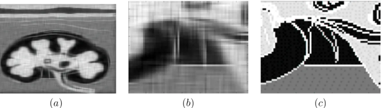 Figure 4.12: a) High Pass Maximum Frequency fusion image (32.66 dB), b) ROI, c) ROI on original image.