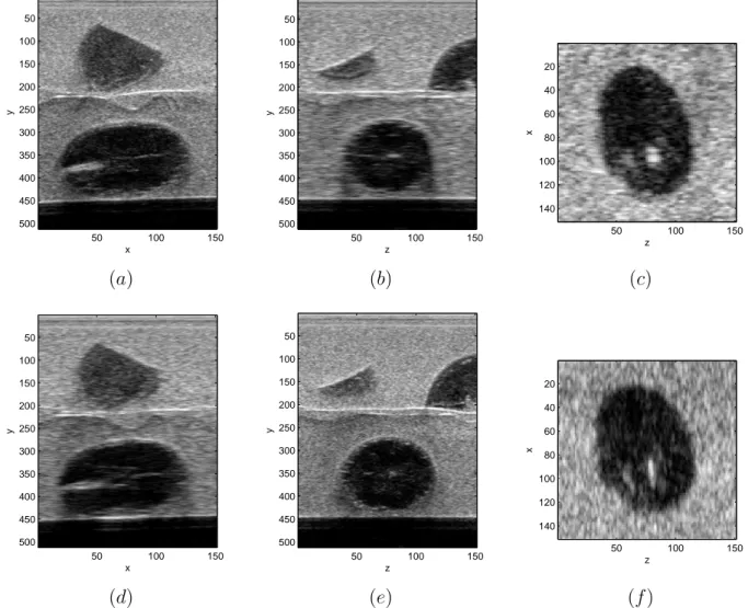 Figure 5.8: Slices of fruit phantom 3D acquisition, zoom on a 3x5x3 cm area, voxel size 0.2x0.1x0.1 mm
