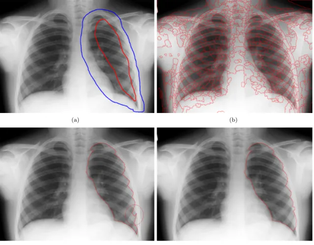 Figure 3.11: Chest X-ray, right lung segmentation. (a) Original Image (1058x769). (b) Markers