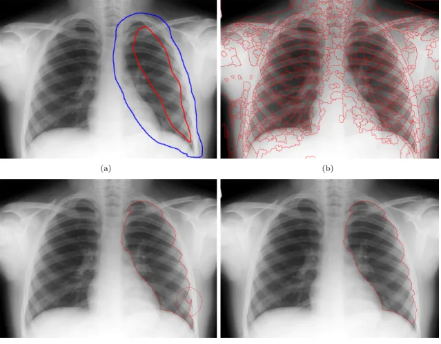 Figure 3.11: Chest X-ray, right lung segmentation. (a) Original Image (1058x769). (b) Markers
