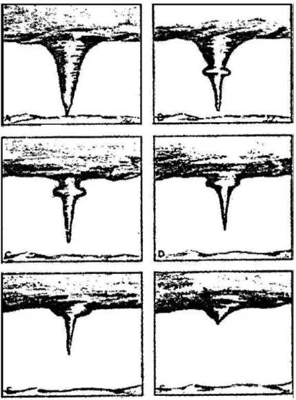 Figure 1.3: Stretching of a vortex breakdown-like phenomena, appeared in South Platte Valley tornadoes of June 7, 1953, adapted from Reber[77].