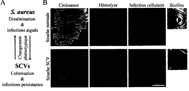 FIGURE  6.  Comparaison  de  certaines  caract^ristiques  phenotypiques  entre  les  souches  normales et  SCVs