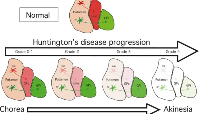 Figure  2.  HD  neuropathology.  Schematic  illustration  of  HD  striatal  degeneration  according  to  Vonsattel 