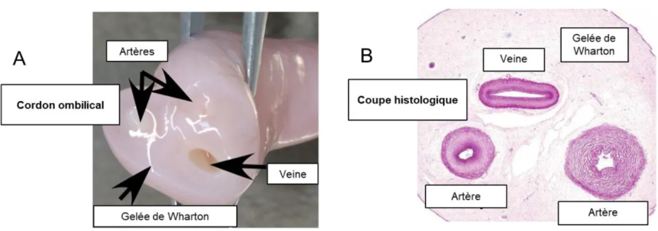 Figure 1 : Anatomie macroscopique et microscopique du cordon ombilical.  