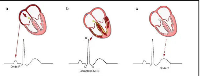 Figure 6 : La contraction des oreillettes se traduit sur l’ECG par une onde positive appelée onde P  (a)