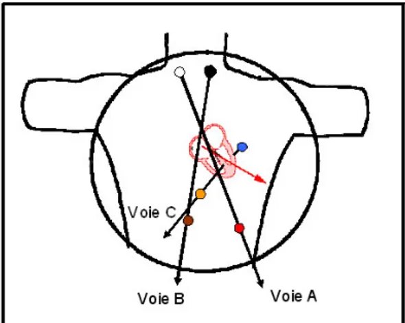 Figure 7: l’emplacement des électrodes est normalisé pour l’enregistrement Holter, et la  représentation du tracé est toujours la même : voie A en haut, voie B au centre et la voie C en bas